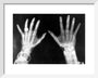 X-rays of the hands of King George and Queen Mary, 1896. art print extra small white Art Print - Science Museum Shop