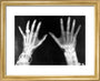 X-rays of the hands of King George and Queen Mary, 1896. art print extra small gold Art Print - Science Museum Shop