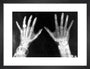 X-rays of the hands of King George and Queen Mary, 1896. art print small black Art Print - Science Museum Shop