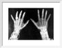 X-rays of the hands of King George and Queen Mary, 1896. art print small white Art Print - Science Museum Shop