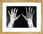 X-rays of the hands of King George and Queen Mary, 1896. art print small gold Art Print - Science Museum Shop