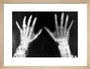 X-rays of the hands of King George and Queen Mary, 1896. art print small natural Art Print - Science Museum Shop