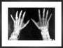X-rays of the hands of King George and Queen Mary, 1896. art print medium black Art Print - Science Museum Shop