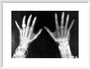 X-rays of the hands of King George and Queen Mary, 1896. art print medium white Art Print - Science Museum Shop