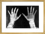 X-rays of the hands of King George and Queen Mary, 1896. art print medium gold Art Print - Science Museum Shop