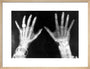 X-rays of the hands of King George and Queen Mary, 1896. art print medium natural Art Print - Science Museum Shop