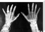 X-rays of the hands of King George and Queen Mary, 1896. stretched canvas medium none Art Print - Science Museum Shop