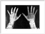 X-rays of the hands of King George and Queen Mary, 1896. art print large white Art Print - Science Museum Shop