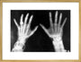 X-rays of the hands of King George and Queen Mary, 1896. art print large gold Art Print - Science Museum Shop