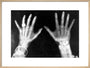 X-rays of the hands of King George and Queen Mary, 1896. art print large natural Art Print - Science Museum Shop