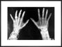 X-rays of the hands of King George and Queen Mary, 1896. art print extra large black Art Print - Science Museum Shop