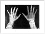 X-rays of the hands of King George and Queen Mary, 1896. art print extra large white Art Print - Science Museum Shop