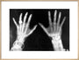 X-rays of the hands of King George and Queen Mary, 1896. art print extra large natural Art Print - Science Museum Shop