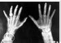X-rays of the hands of King George and Queen Mary, 1896. stretched canvas extra large none Art Print - Science Museum Shop