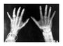 X-rays of the hands of King George and Queen Mary, 1896. unstretched canvas extra large none Art Print - Science Museum Shop