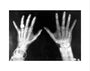 X-rays of the hands of King George and Queen Mary, 1896. art print extra small none Art Print - Science Museum Shop