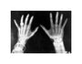 X-rays of the hands of King George and Queen Mary, 1896. unstretched canvas small none Art Print - Science Museum Shop