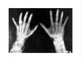 X-rays of the hands of King George and Queen Mary, 1896. art print medium none Art Print - Science Museum Shop