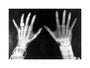 X-rays of the hands of King George and Queen Mary, 1896. unstretched canvas medium none Art Print - Science Museum Shop