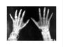 X-rays of the hands of King George and Queen Mary, 1896. art print large none Art Print - Science Museum Shop