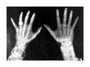 X-rays of the hands of King George and Queen Mary, 1896. unstretched canvas large none Art Print - Science Museum Shop