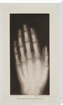 Hand of an 8 year-old girl, 1896. stretched canvas extra large none Art Print - Science Museum Shop