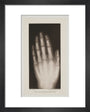 Hand of an 8 year-old girl, 1896. art print extra small black Art Print - Science Museum Shop