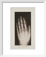 Hand of an 8 year-old girl, 1896. art print extra small white Art Print - Science Museum Shop