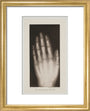 Hand of an 8 year-old girl, 1896. art print extra small gold Art Print - Science Museum Shop