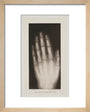 Hand of an 8 year-old girl, 1896. art print extra small natural Art Print - Science Museum Shop