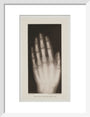 Hand of an 8 year-old girl, 1896. art print small white Art Print - Science Museum Shop