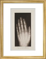 Hand of an 8 year-old girl, 1896. art print small gold Art Print - Science Museum Shop