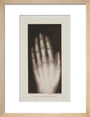 Hand of an 8 year-old girl, 1896. art print small natural Art Print - Science Museum Shop