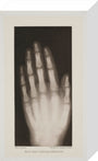 Hand of an 8 year-old girl, 1896. stretched canvas small none Art Print - Science Museum Shop