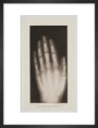 Hand of an 8 year-old girl, 1896. art print medium black Art Print - Science Museum Shop