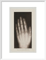 Hand of an 8 year-old girl, 1896. art print medium white Art Print - Science Museum Shop