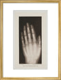 Hand of an 8 year-old girl, 1896. art print medium gold Art Print - Science Museum Shop