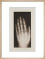 Hand of an 8 year-old girl, 1896. art print medium natural Art Print - Science Museum Shop