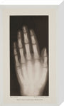 Hand of an 8 year-old girl, 1896. stretched canvas medium none Art Print - Science Museum Shop
