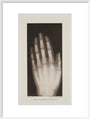 Hand of an 8 year-old girl, 1896. art print large white Art Print - Science Museum Shop