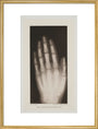 Hand of an 8 year-old girl, 1896. art print large gold Art Print - Science Museum Shop