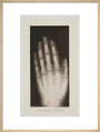 Hand of an 8 year-old girl, 1896. art print large natural Art Print - Science Museum Shop