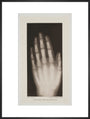 Hand of an 8 year-old girl, 1896. art print extra large black Art Print - Science Museum Shop
