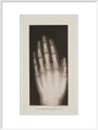 Hand of an 8 year-old girl, 1896. art print extra large white Art Print - Science Museum Shop