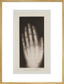 Hand of an 8 year-old girl, 1896. art print extra large gold Art Print - Science Museum Shop