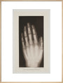 Hand of an 8 year-old girl, 1896. art print extra large natural Art Print - Science Museum Shop