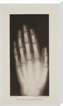 Hand of an 8 year-old girl, 1896. stretched canvas large none Art Print - Science Museum Shop