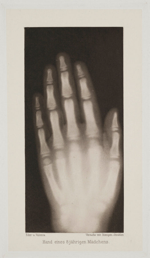 Hand of an 8 year-old girl, 1896. Art Print - Science Museum Shop