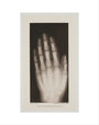 Hand of an 8 year-old girl, 1896. art print extra small none Art Print - Science Museum Shop