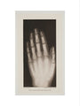 Hand of an 8 year-old girl, 1896. art print small none Art Print - Science Museum Shop